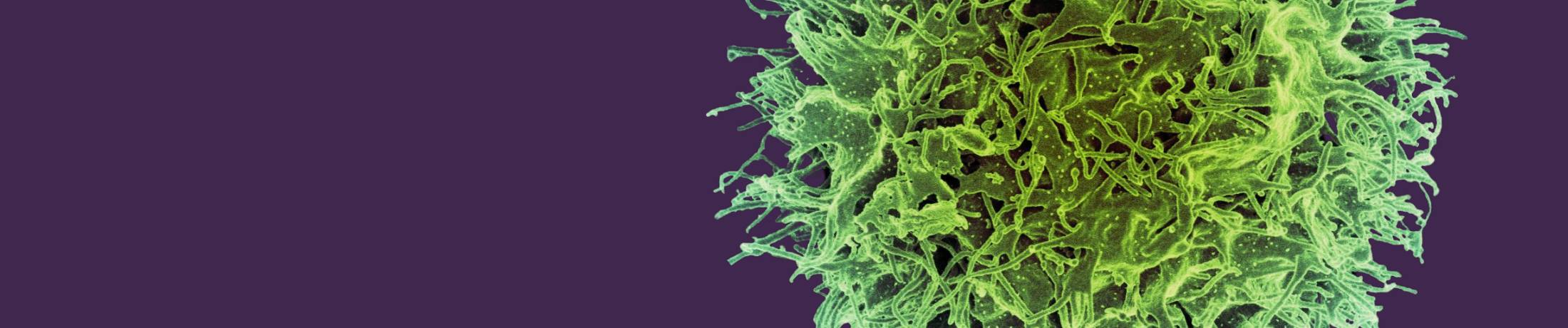 Featured image for “Revolutionizing Cancer Treatment: A Groundbreaking Approach to Immune System Activation”
